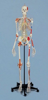 Skelett Rüdiger 206